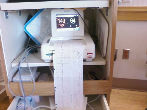 Here is our equipment for the events today. Looking for smooth valleys to signal contractions.