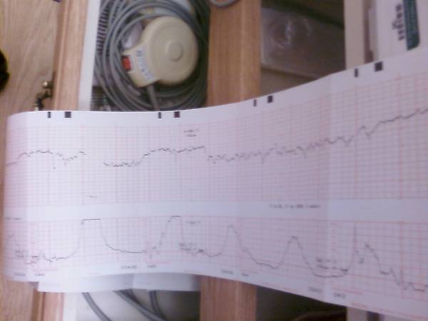 Here's the contractions' progress. Nice and regular.