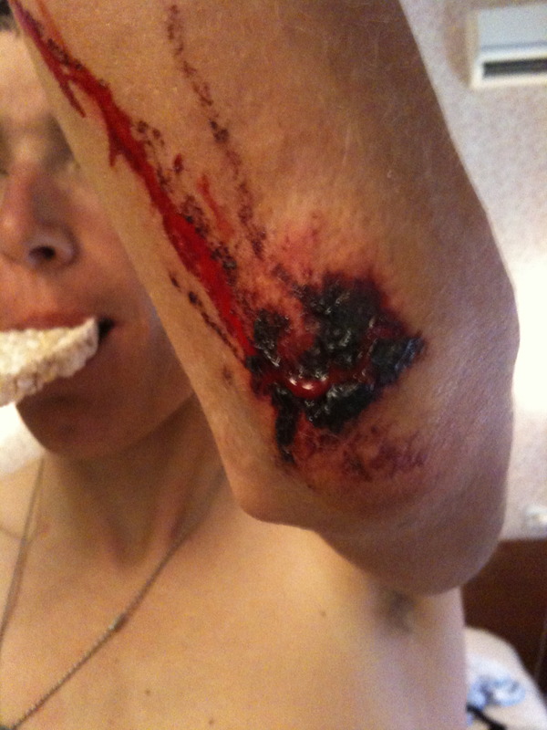 THATS WHAT HAPPENS IF U CRASH UPHILL. 
