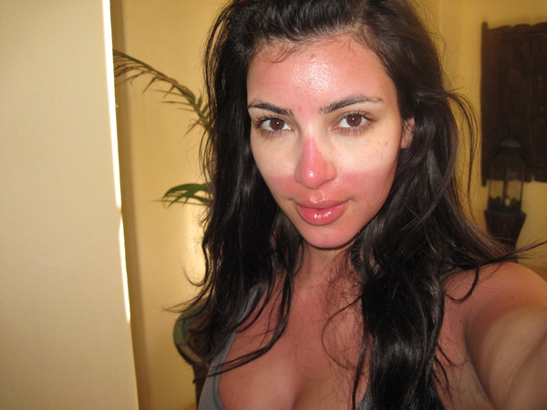 PLEASE HELP ME! I am so sunburned! I fell asleep with huge glasses on yesterday! This tan line is not ok!!!