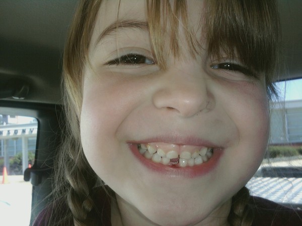 Ali's tooth is finally out :) Big girl.
