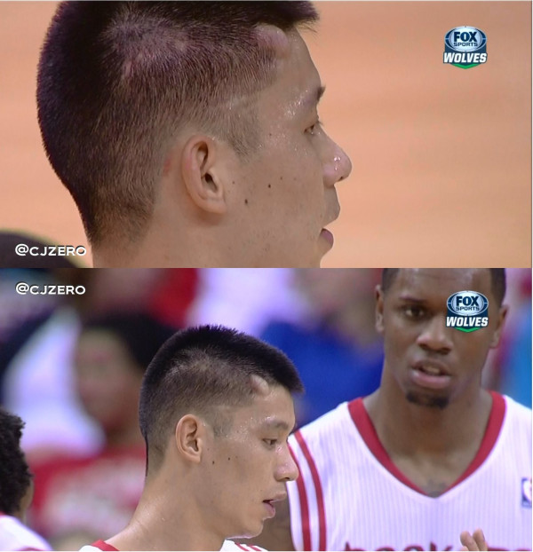 A Kevin Love elbow gave Jeremy Lin a huge egg on his head