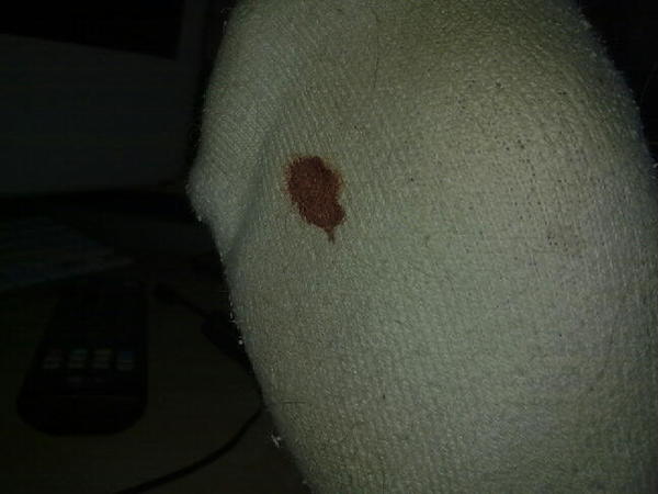 I don't know what i did, but i found a blood trail through the house and a rather large stain in my shoe.