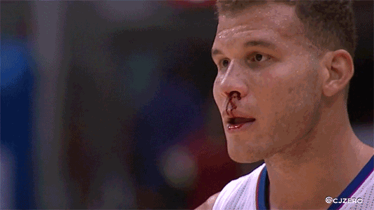 GIF: A bloody Blake Griffin asks referee "How did this happen?" (for the record, Ibaka's hand)